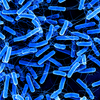 Picture of bacteria: In the field of bacterial infection research the HIRI aims to develop new ways to rapidly diagnose and treat bacterial infections. 