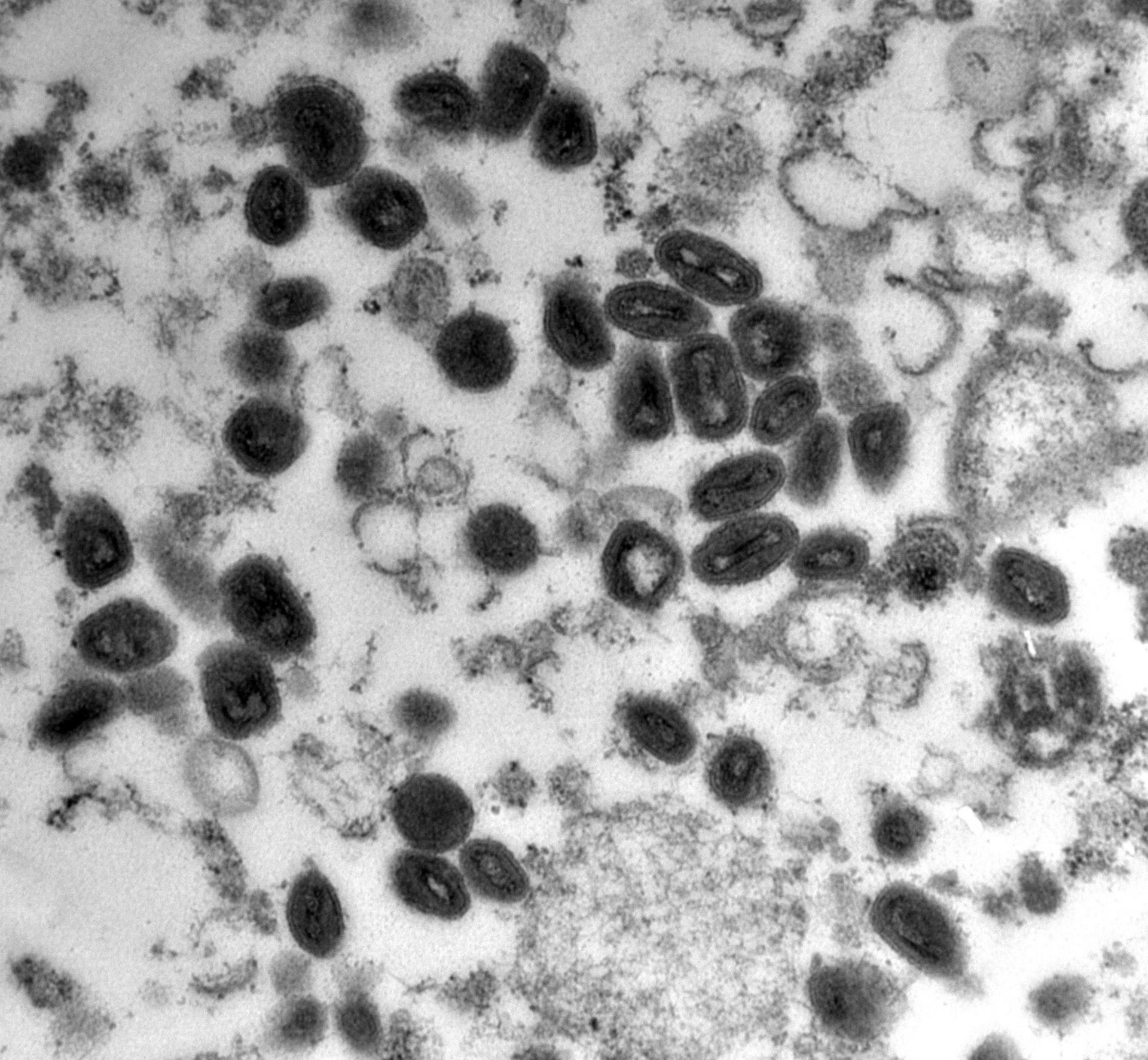 Image of smallpox viruses under the microscope