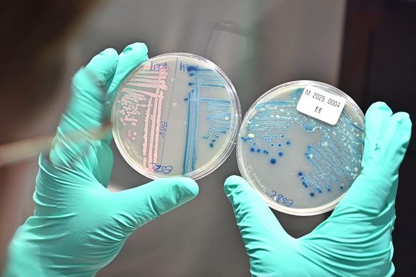 Researcher holds two agar plates