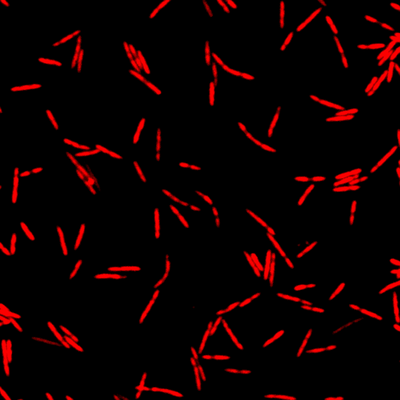 Visualisierung von Fusobakterien. © HIRI