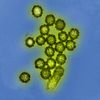 Picture of viruses: With regard to viral infection research, HIRI scientists aim to unravel the role of RNA in productive viral infections and persistence. 
