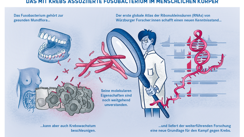 Schaubild über das Fusobacterium im menschlichen Körper