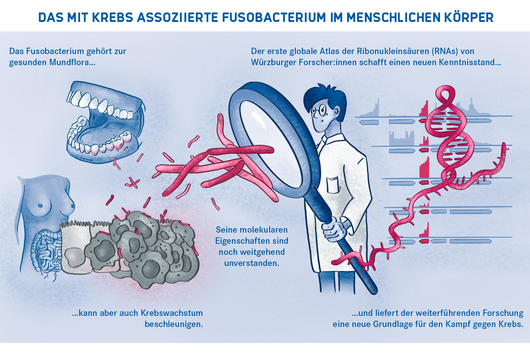 Schaubild über das Fusobacterium im menschlichen Körper