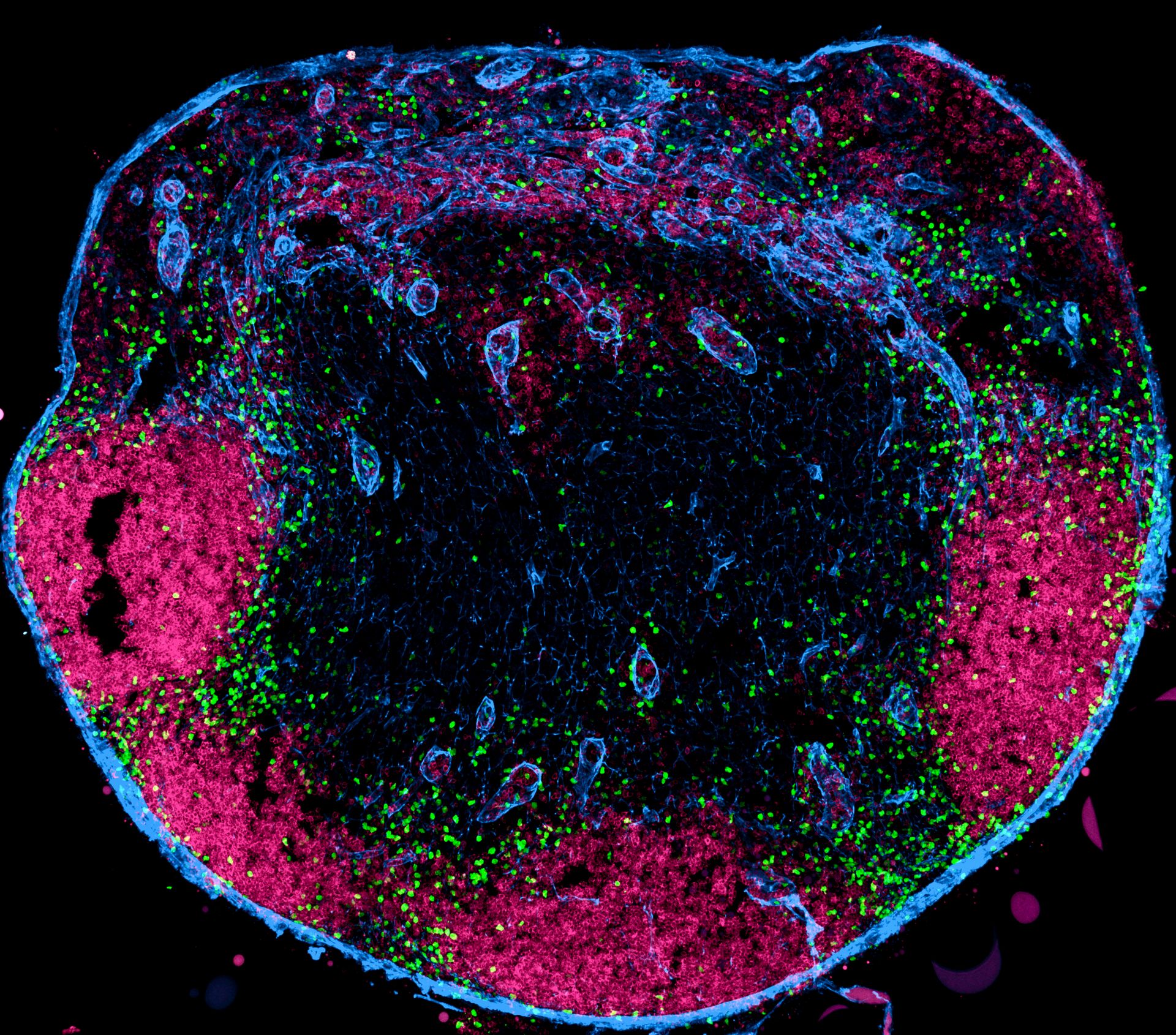 Image of a cross-section through a lymph node