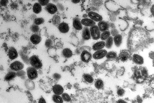 Image of smallpox viruses under the microscope